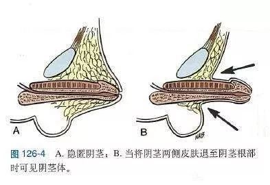 仿真陽具哪種好以及仿真陽具的介紹